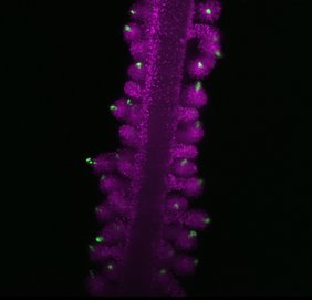 Das Bild zeigt weibliche meiotische Zellen (markiert durch ASY1‑eYFP in Grün), eingebettet in somatische Zellen (markiert durch H2B‑mRuby2 in Magenta) in den weiblichen Reproduktionsorganen von Arabidopsis. Das Bild zeigt weibliche meiotische Zellen (markiert durch ASY1‑eYFP in Grün), eingebettet in somatische Zellen (markiert durch H2B‑mRuby2 in Magenta) in den weiblichen Reproduktionsorganen von Arabidopsis.