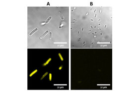 Die Fluoreszenzmarkierung des von der Gruppe Werz entwickelten synthetischen Pseudaminsäure-Derivats erfolgt gezielt auf Bakterien
