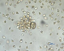 Ein Schwarm von Prymnesien (aus einer Zellkultur des IGB) befällt eine zugegebene Kieselalge. Die Mikroalgen lysieren diese, um den aufgelösten Zellinhalt aufzunehmen.