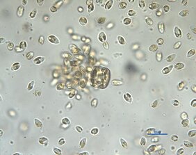 Ein Schwarm von Prymnesien (aus einer Zellkultur des IGB) befällt eine zugegebene Kieselalge. Die Mikroalgen lysieren diese, um den aufgelösten Zellinhalt aufzunehmen.
