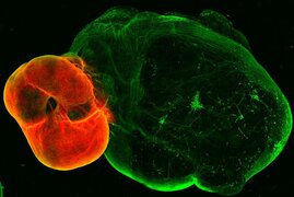 Dopaminerge Neuronen in einem Gehirnorganoid.