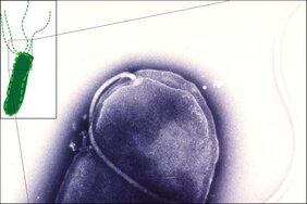 Helicobacter pylori-Bakterium