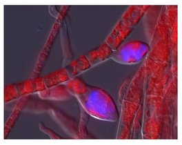 Virus-Symptome bei der fadenförmigen Braunalge Ectocarpus sp., wobei die DNA-Färbung (blau) auf eine Virusvermehrung in den Fortpflanzungsstrukturen der Alge hinweist. Virus-Symptome bei der fadenförmigen Braunalge Ectocarpus sp., wobei die DNA-Färbung (blau) auf eine Virusvermehrung in den Fortpflanzungsstrukturen der Alge hinweist.
