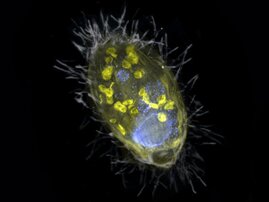 Der Endosymbiont und sein Wirt, ein Wimpertierchen.  