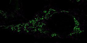 Fragmentierung von Mitochondrien Herpesviren