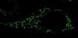 Fragmentierung von Mitochondrien Herpesviren