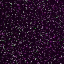 1) Gram-negative bakterielle Krankheitserreger (grün) umgeben von einem Proteinmantel aus GBP1-Proteinen