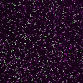 1) Gram-negative bakterielle Krankheitserreger (grün) umgeben von einem Proteinmantel aus GBP1-Proteinen