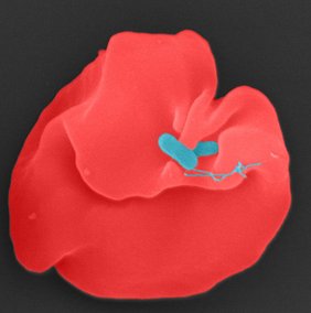 Bartonella bacilliformis (blau) infiziert einen menschlichen Erythrozyten. Bartonella bacilliformis (blau) infiziert einen menschlichen Erythrozyten.