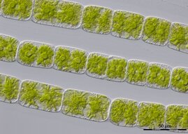Mikroskopische Aufnahme von Zygnema circumcarinatum, einer fadenförmigen Alge mit einem sternförmigen Chloroplasten.