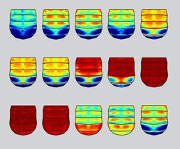 Die Bilder zeigen den Hinterleib von Fliegen, in denen eine spezifische Enhancer-Region modifiziert wurde. 