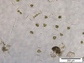 Nordsee-Plankton
