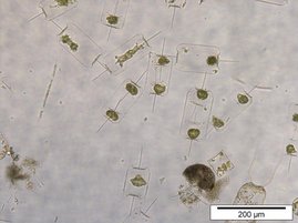 Nordsee-Plankton