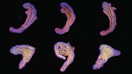 Collage von Stammzell-basierten Embryo-Modellen des embryonalen Rumpfes  