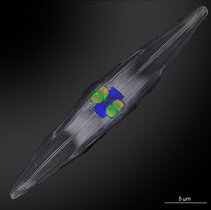 Die den Rhizobien-zugehörigen stickstofffixierenden Symbionten (mit fluoreszierenden Gensonden markiert in orange und grün) befinden sich innerhalb von Kieselalgen, die im tropischen Nordatlantik gesammelt wurden. Der Zellkern der Kieselalge ist in blau zu sehen