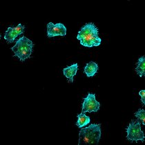 Bilder von Immunsynapsen, die von NK-92-Zellen gebildet werden. Rot: zytotoxische/lytische Granula; Grün: Sphingolipide, GM1 oder GB3; Cyan: Actin-Färbung Bilder von Immunsynapsen, die von NK-92-Zellen gebildet werden.