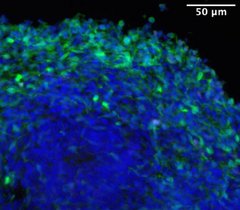 Ein Gehirnorganoid, das synthetischen Glukokortikoiden ausgesetzt wurde. Viele hemmende Neuronen (in Grün) sind sichtbar. 