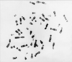 Anfärbung der DNA einer gesunden menschlichen Zelle mit insgesamt 26 Chromosomen.