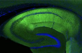   Fluoreszenzbild eines Hippokampus-Schnitts einer Maus. Synapsen sind grün dargestellt, die Zellkörper der Neuronen blau