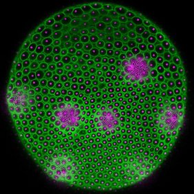 Volvox-Elternsphäroid: An der gesamten Oberfläche sind viele einzelne Zellen als magentafarbene Punkte zu sehen, in wenigen größeren Gruppen mit sehr kleinen Punkten erscheinen heranwachsende Tochtersphäroide.