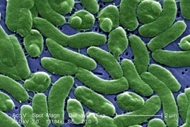 Bakterien der Art Vibrio vulnificus (hier eine Rasterelektronenmikroskop-Aufnahme)