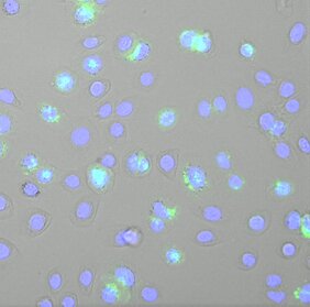 Keratinozyten-Zelllinie, die mit Semliki-Forest-Virus infiziert wurde