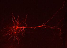 Morphologische Rekonstruktion eines Neurons des cingulären Kortex bei Migräne.