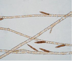 Mikroskopische Aufnahme von Braunalgen 