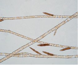 Mikroskopische Aufnahme von Braunalgen 
