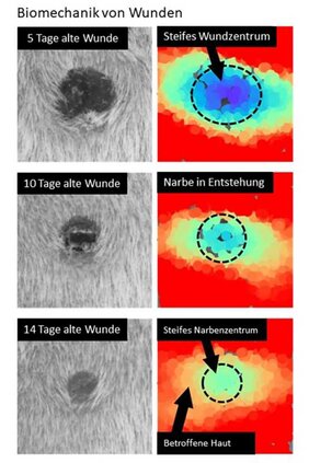 Wundmorphologie (linke Spalte) und Deformierbarkeit der Narbe in vivo.
