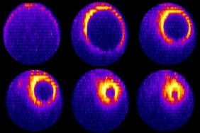 Bestandteile des kontraktilen Rings wurden mit Fluoreszenzproteinen markiert und konnten so mit einem Fluoreszenzmikroskop sichtbar gemacht werden.