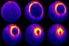 Bestandteile des kontraktilen Rings wurden mit Fluoreszenzproteinen markiert und konnten so mit einem Fluoreszenzmikroskop sichtbar gemacht werden.