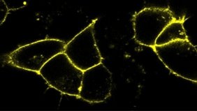 Menschliche Nierenzellen, deren Zellmembranen mit leuchtenden Biosensoren markiert sind. 