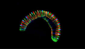 raupenartiges Bakteriums Conchiformibius steedae