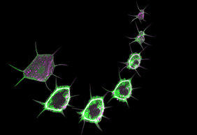 Zusammenstellung von Bildern aus einem Video, dass die Wundheilung in der Epidermis einer Drosophila Larve zeigt. Die Zellen exprimieren zwei fluoreszierende Marker: einen PIP3 Sensor (grün) und die leichte Myosin Kette (magenta).