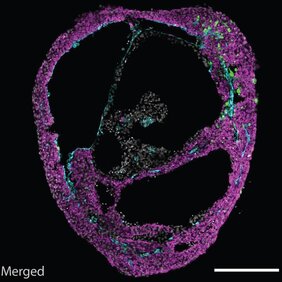 Mikroskopiebild eines selbstorganisierenden Herz-Organoids