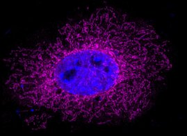 Das ARHGAP11B-Protein (Magenta) ist in den Mitochondrien vorhanden. Der Zellkern wird durch DAPI (blau) visualisiert. 