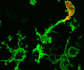  Mikroskopisches Bild von grün angefärbten Makrophagen nach einem Schlaganfall: Die zusätzlich rot gefärbte Zelle (r.o.) entstammt dem Knochenmark, die rein grünen Zellen sind ansässige Mikroglia.