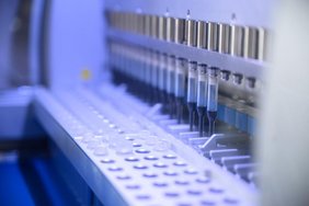 Die Arbeitsgruppe PGC Anxiety identifizierte in der genomweiten Assoziationsstudie 74 Positionen im Genom, an denen genetische Unterschiede mit Angstsymptomen in Zusammenhang standen. Sequenzierermaschine
