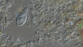 Klärschlammprobe mit diversen Bakterien und einem räuberischen Protisten