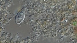 Klärschlammprobe mit diversen Bakterien und einem räuberischen Protisten