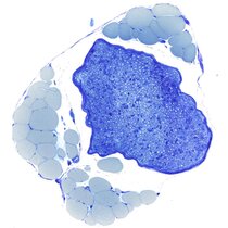 Mikroskopischer Querschnitt durch ein peripheres Nervenbündel (dunkelblau), welches hunderte von Schwann-Zellen ummantelte Nervenfasern enthält.