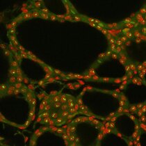 Mit Fluoreszenz-in-situ-Hybridisierung sichtbar gemachte Transkriptionsschleifen