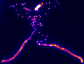 Fluoreszenzmikroskopische Aufnahme von Ustilago maydis-Hyphen Fluoreszenzmikroskopische Aufnahme von Ustilago maydis-Hyphen