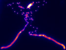 Fluoreszenzmikroskopische Aufnahme von Ustilago maydis-Hyphen Fluoreszenzmikroskopische Aufnahme von Ustilago maydis-Hyphen