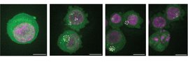 Die Bildfolge zeigt eine Zelle mit Mikrokernen, die den Zelltod durchläuft. Das Chromatin ist pink gefärbt, die ringförmige DNA leuchtet grün. Die gestrichelte weiße Linie markiert die Mikronuklei. Die Bildfolge zeigt eine Zelle mit Mikrokernen, die den Zelltod durchläuft.