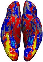 3D-Rekonstruktion des Gehirns 3D-Rekonstruktion des Gehirns