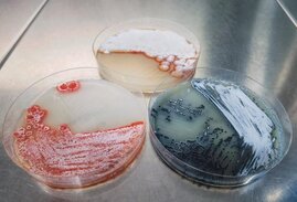 Kulturen unterschiedlicher Streptomyces-Stämme. Kulturen unterschiedlicher Streptomyces-Stämme.