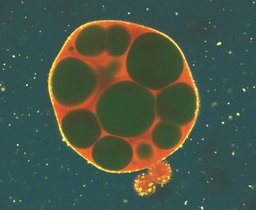 RNA-Tröpfchen, in dessen Innerem sich durch Mutation mehrere Hohlräume (grün) gebildet haben. RNA-Tröpfchen, in dessen Innerem sich durch Mutation mehrere Hohlräume (grün) gebildet haben.