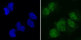 SAMD1 (grün) in den Kernen (blau) von Säugetierzellen